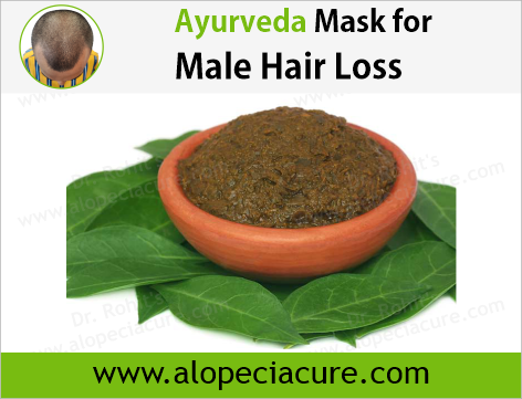 male hair loss treatment