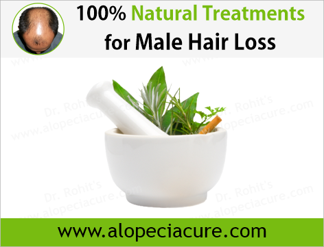 male hair loss treatment