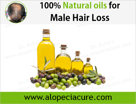 male hair loss treatment