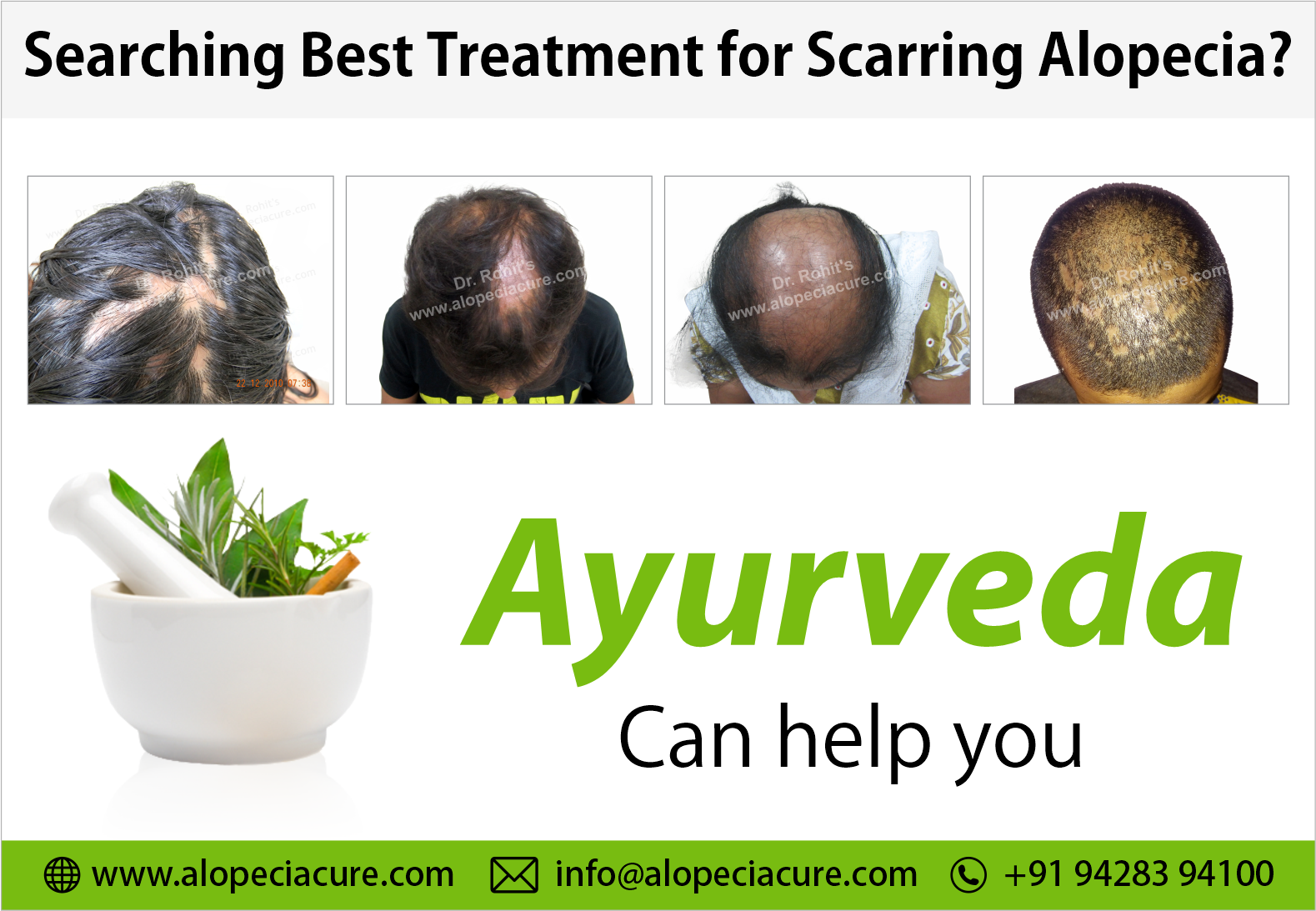Naturopathy Treatment
