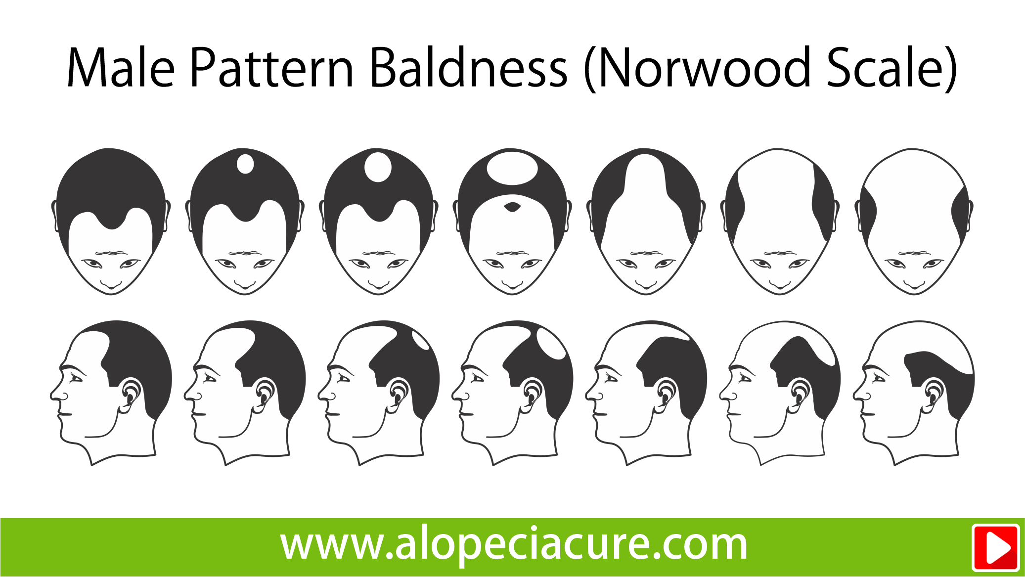 male hair loss treatment
